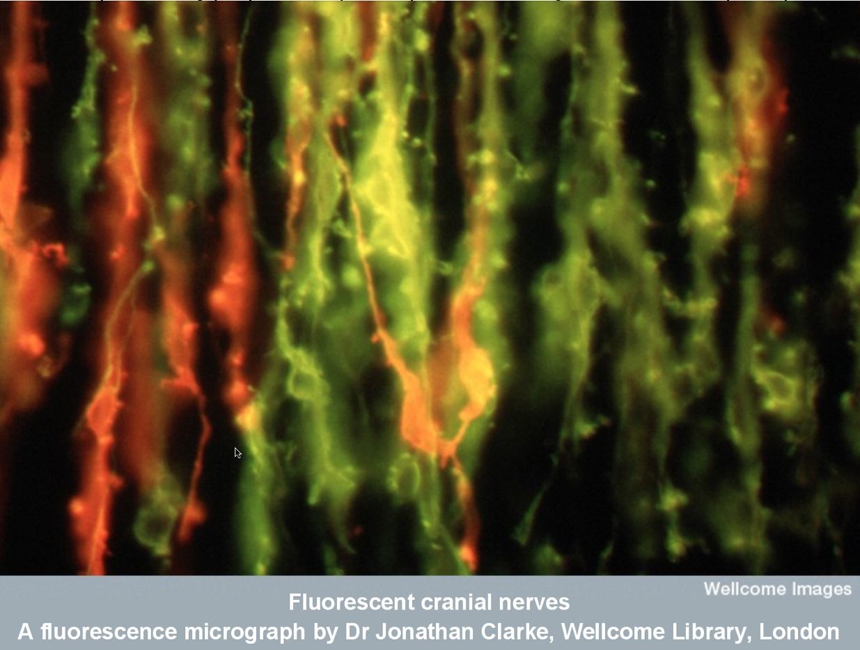 Fluorescent cranial nerves